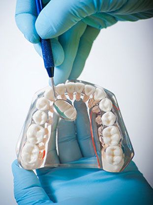 Dental Sirera prótesis dental