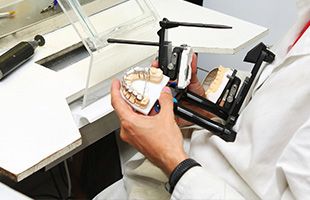 Dental Sirera persona con prótesis dental en mano