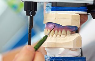 Dental Sirera revisando prótesis dental